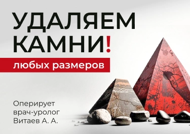 Удаляем камни